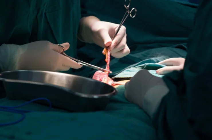 Gallbladder & Appendix Surgeries------11