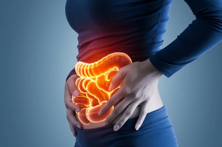 IBD Surgeries------11